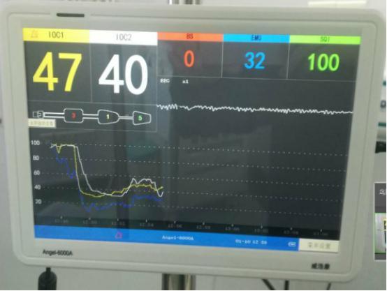 臨床心得和手術案例分析